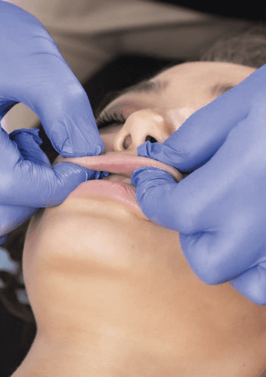 Kinesiolifting facial en Oviedo - Centro de Estética Lorena